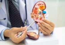 СÈ ШТО ТРЕБА ДА ЗНАЕТЕ ЗА ЗАБОЛУВАЊЕТО НА БУБРЕЗИТЕ ВО СТАДИУМ 2