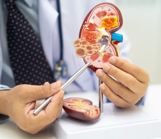 СÈ ШТО ТРЕБА ДА ЗНАЕТЕ ЗА ЗАБОЛУВАЊЕТО НА БУБРЕЗИТЕ ВО СТАДИУМ 2