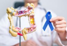 ПЕТ ВИДОВИ ХРАНА КОИ ДОКТОРИТЕ НИКОГАШ НЕ ГИ ЈАДАТ ПОРАДИ РИЗИК ОД РАК НА ДЕБЕЛОТО ЦРЕВО