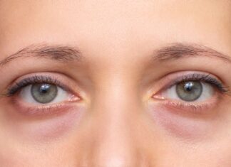 ТЕМНИТЕ КРУГОВИ НЕ СЕ САМО ЕСТЕТСКИ ПРОБЛЕМ